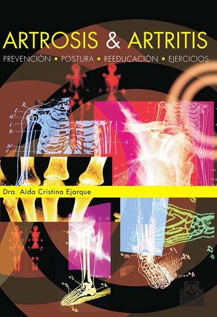 ARTROSIS Y ARTRITIS | 9788480190404 | EJARQUE, AIDA | Galatea Llibres | Librería online de Reus, Tarragona | Comprar libros en catalán y castellano online