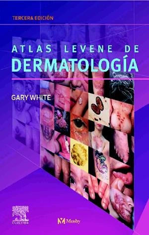 ATLAS LEVENE DE DERMATOLOGIA 3 ED | 9788481747652 | WHITE, GARY | Galatea Llibres | Llibreria online de Reus, Tarragona | Comprar llibres en català i castellà online