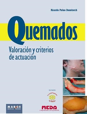 QUEMADOS. VALORACIÓN Y CRITERIOS DE ACTUACIÓN | 9788415340140 | PALAO DOMÉNECH, RICARDO | Galatea Llibres | Llibreria online de Reus, Tarragona | Comprar llibres en català i castellà online