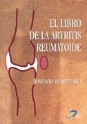 LIBRO DE LA ARTRITIS REUMATOIDE, EL | 9788479785819 | ALVAREZ LARIO, BONIFACIO | Galatea Llibres | Librería online de Reus, Tarragona | Comprar libros en catalán y castellano online